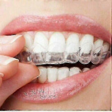 PARK15pcs Silicone Mouth Guard Night Teeth Clenching Grinding Sleep Dental Tool- Teeth Grinding Mouth Guard