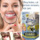 Multi-Shade Instant Temporary Smile Temporary Replacement Teeth Kit 4
