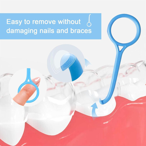 Pack of 7 Aligner Removal Tools, Invisible Braces Remover for Easy and Safe Teeth Alignment Adjustments 1