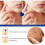 (3pcs, Multicolor) wart remover ointment for genital herpes treatment 3pcs 3