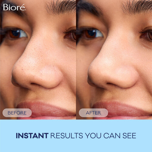 Biore Deep Cleansing Pore Strips For Nose - 14 Ea 2