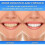 Peachloft Toothpaste,Peachloft Teeth Whitening Toothpaste,Peach Mint Toothpastes 3