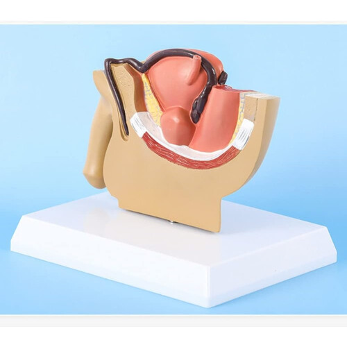 1:2 Male Pelvis Model with Sagittal Cut for Testicles, Prostate, Bladder, Rectal, and Urinary System Study 1