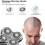 grasmaaier met lithium-ionbatterij, type 755 motor 3