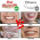 Veneers Snap On False Teeth Instant Smile Cosmetic Dentures Dental 4
