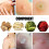 12Pcs Corn Removal Plasters Natural Active Ingredients Square Shape 6