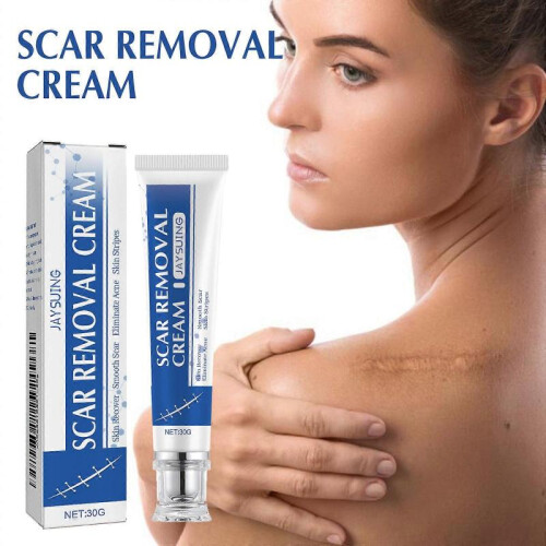 (2pcs)1-3x Acnes Scars Removal Cream Effectiveness Non-irritating Cream For Face 1