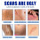 (2pcs)1-3x Acnes Scars Removal Cream Effectiveness Non-irritating Cream For Face 4