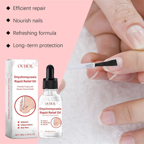Ouhoe 10ml Antifungal Nail Repair Solution: A Fast And Effective Solution For 2