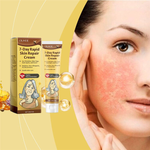 Ouhoe Skin Repair Cream 1
