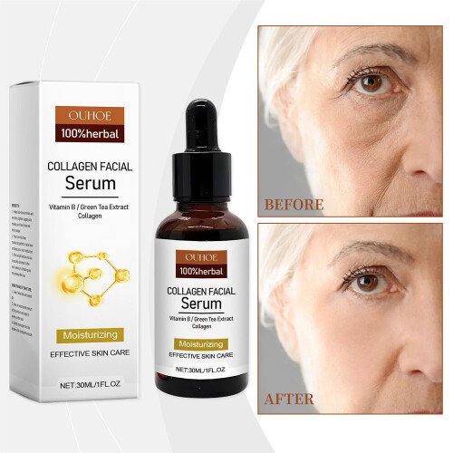 Ouhoe Collagen Brightening Essence Oua05 1