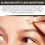 West&Month Micro-needle Vitamin C Spot Eraser 6