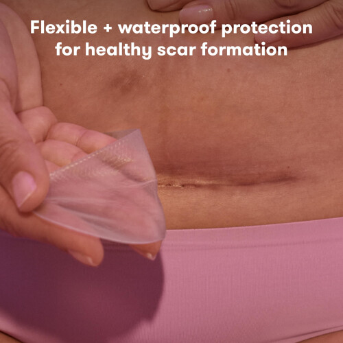 Frida Mom C-Section Silicone Strips: C-Section Recovery Must Have S... 1
