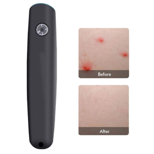 Insect Sting and Bite Relief Pen Mosquito Bug Bite 1