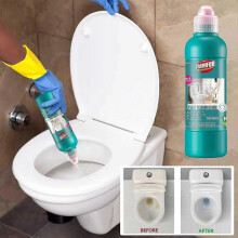 Toilet Cleaner Toilet Cleaner And Toilet Liquid Are Powerful In Removing Stains Odors And Scale In Bathrooms And Bathrooms 500ml s