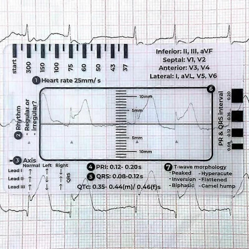 3Pc ECG 7 Step Ruler ECG 7 Step Ruler For ECG/EKG Interpretation ECG Reference Guide Ruler EKG Calipers 1