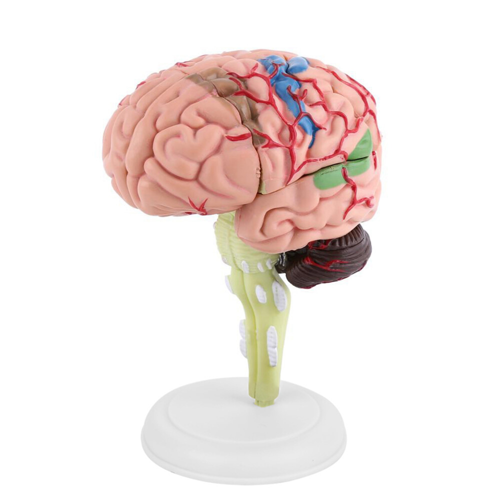 1pc Disassembled Anatomical Human Brain Model
