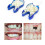 Temporary Tooth Repair Kit Teeth And Gaps Teeth Teeth Whitening Tooth Back Teeth 3