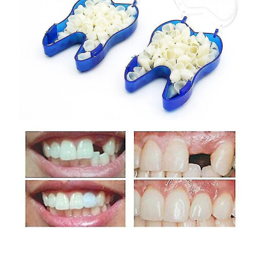 Temporary Tooth Repair Kit Teeth And Gaps Teeth Teeth Whitening Tooth Back Teeth 2