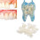 Temporary Tooth Repair Kit Teeth And Gaps Teeth Teeth Whitening Tooth Back Teeth 10