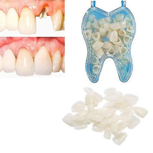 Temporary Tooth Repair Kit Teeth And Gaps Teeth Teeth Whitening Tooth Back Teeth 1
