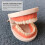 Removable Tooth Model Denture Teaching Oral Education Standard Teeth 4