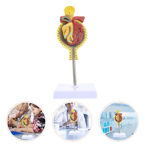 1 stks Menselijk Glomerulus Medisch Anatomie Model met Voetstuk 2