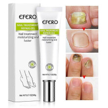 Efero Nail Exfoliation Plant Nail Repair Fluid Nail Cream Nail Treatment Gel Nail Repair Gel Moisturizing Nail Luster