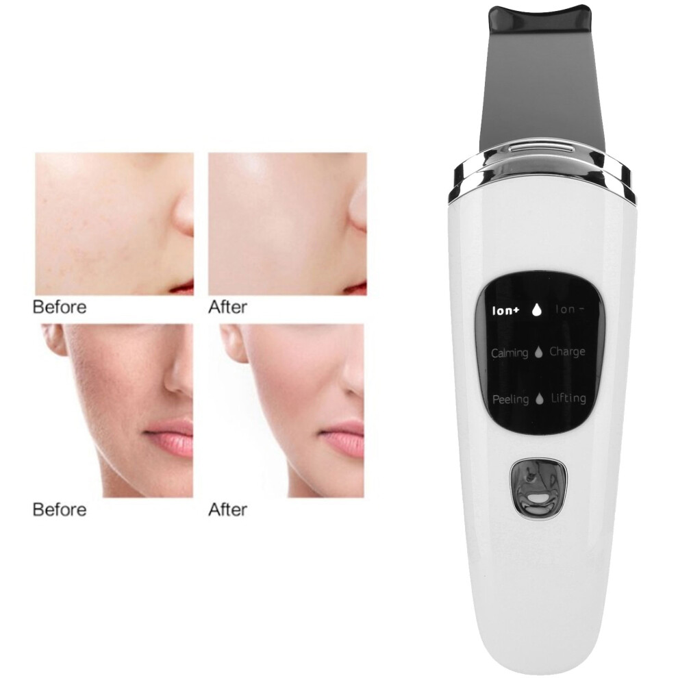 White Ultrasonic Skin Scrubber Lcd Blackhead Remover Face Cleaner 2W