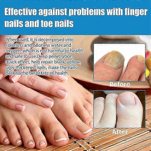 (3pcs) Nail repair spray for soft and thick nails 100ml 1