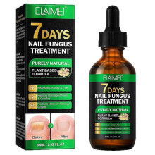 Toenail Fungus Nail Treatment Extra Strength Ginger Nail Treatmant Nail Support Nail Care, Nail Treatmant, Nail Strengthener Ginger Nail Growth Serum