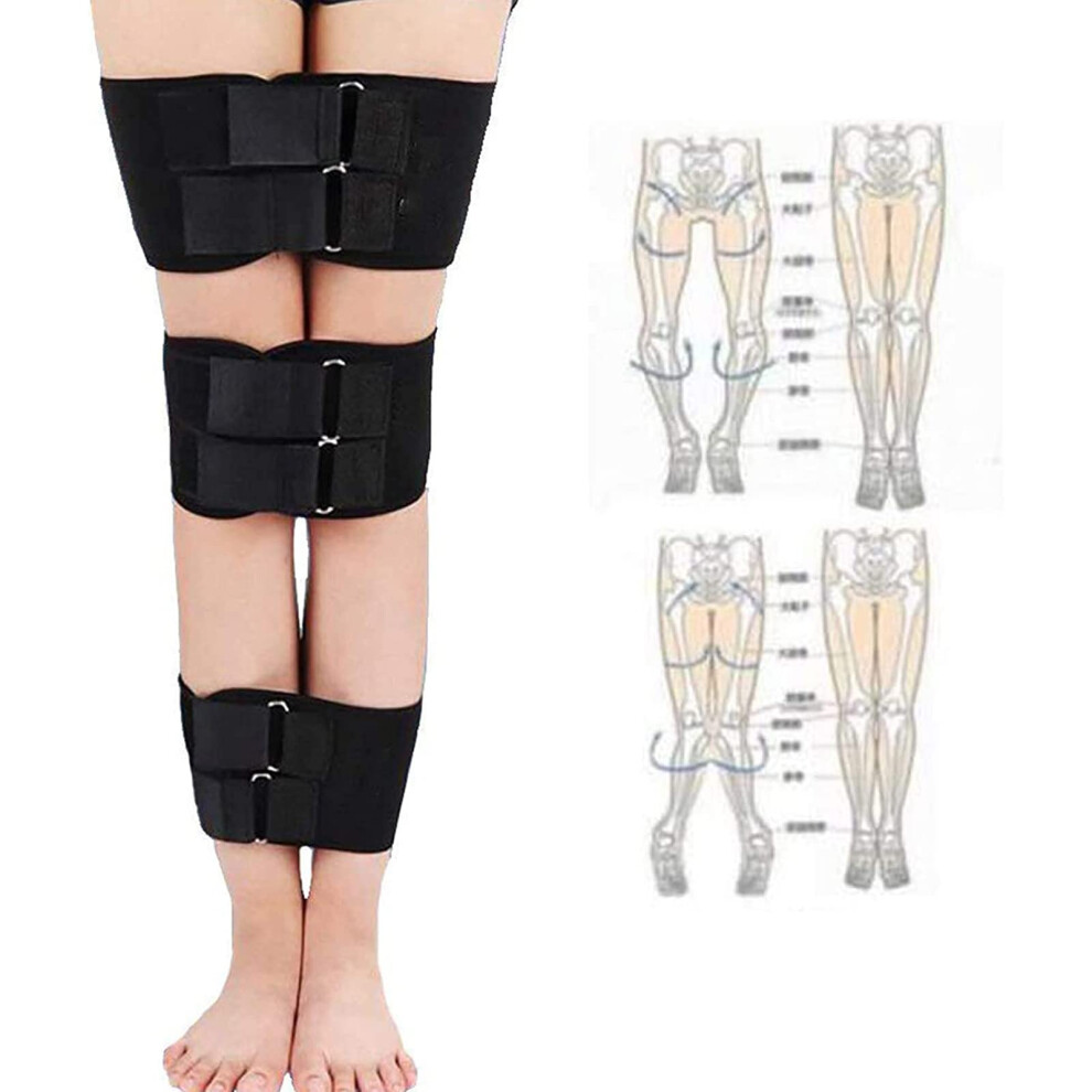 Leg Correction Belt for Knee Valgus Deformity, Adjustable X/O Form Stabilizer for Adult Recovery Support, Patient Aid