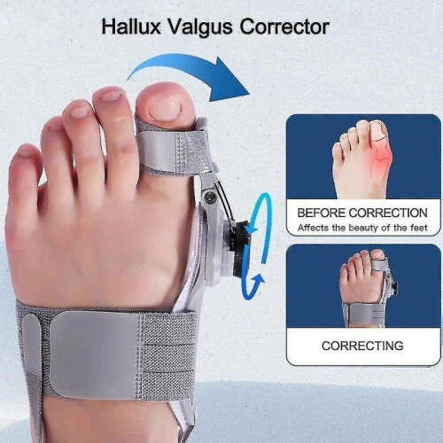 Treatmedy Bunion Fix 1