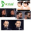 Ustar Ίνες Μαλλιών για Αδύναμα Μαλλιά 12g Auburn Καλύπτει Άμεσα την Αραίωση 5