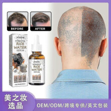 Jaysuing Fermented Rice Water Hair Essence Anti-hair Nourishing Liquid Hair Long Hair Moisturizing Shampoo Essence Free Shipping |