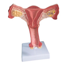 Anatomical Female Internal Reproductive Organ Ovary Model
