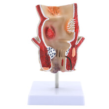 Human Rectum Model for Anatomy Pathologies of Rectum Model