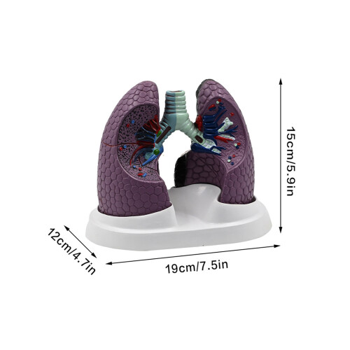 Human Anatomical Lung Model Realistic Pathological Lung Anatomy 2