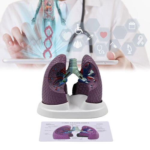 Human Anatomical Lung Model Realistic Pathological Lung Anatomy 1