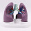 Human Anatomical Lung Model Realistic Pathological Lung Anatomy 7