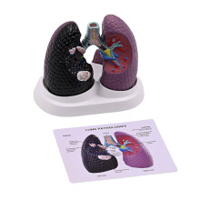 Human Anatomical Lung Model Realistic Pathological Lung Anatomy
