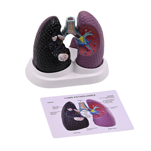 Human Anatomical Lung Model Realistic Pathological Lung Anatomy