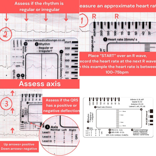 EKG Interpretation Guide Card Convenient EKG Assessment Tool 1