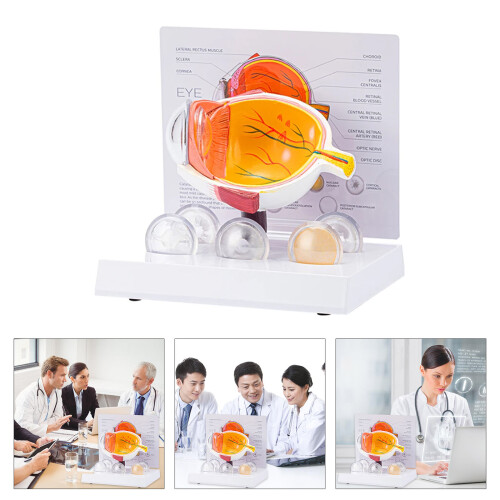 Human Anatomical Eye Model Realistic Pathological Eyeball 2