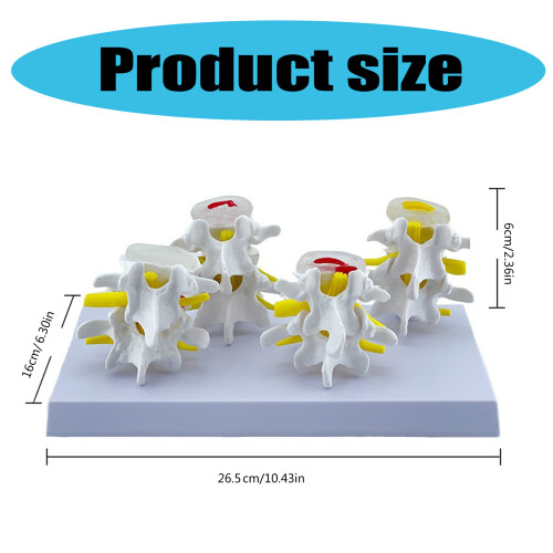 Human Lumbar Vertebrae Model Nursing Model Human Skeleton Model 2