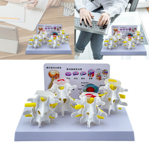 Human Lumbar Vertebrae Model Nursing Model Human Skeleton Model 1