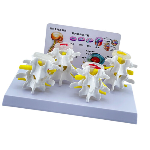 Human Lumbar Vertebrae Model Nursing Model Human Skeleton Model