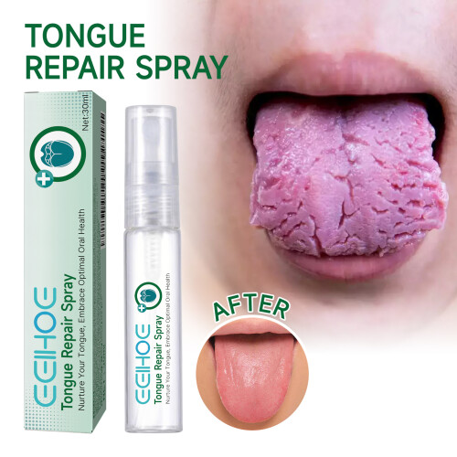 Spray Buccal Apaisant pour Langue Irritée ou Sèche - Confort Immédiat 1