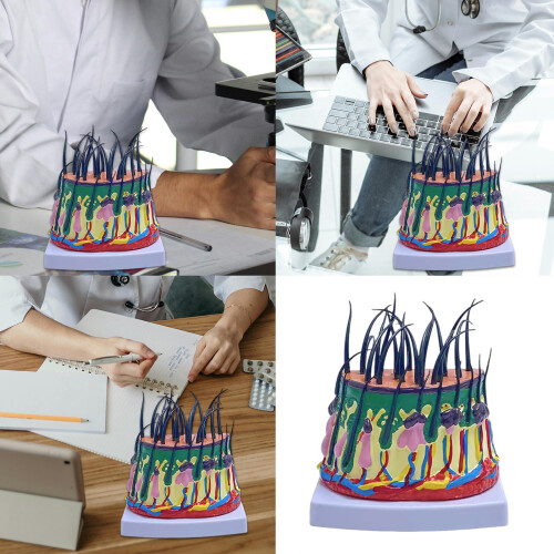 Human Scalp Model 50X Enlarged Scalp Structure Anatomical Model 1