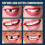 EELHOE 30ml Moldable Teeth Glue 4 Dental Tools Temporary Tooth Filling S 2